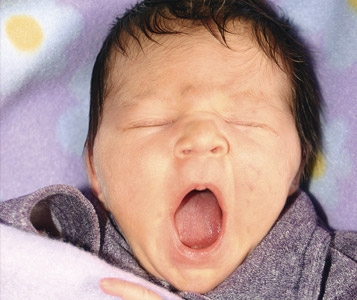 Maux de ventre, bébé chevelu?