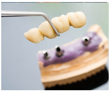 J’ai une dent contre mon dentiste!