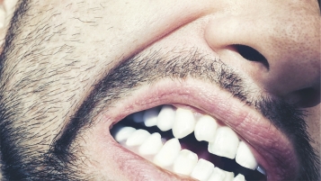 Facture de dentiste: savoir montrer les dents