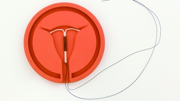 Cervical Cancer Risk