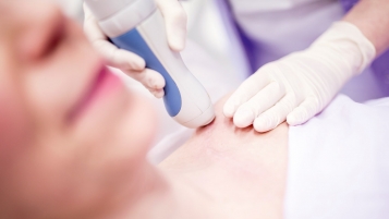 Prestation au laser remboursée par l’assurance maladie