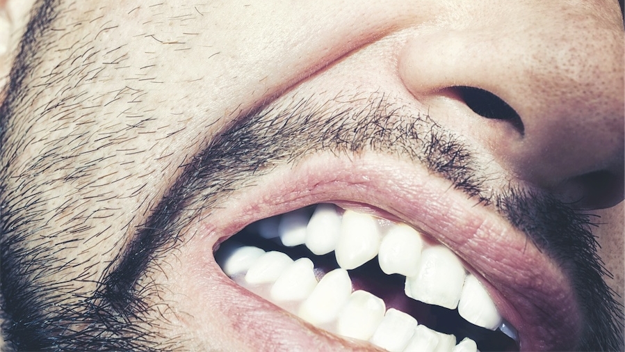 Facture de dentiste: savoir montrer les dents