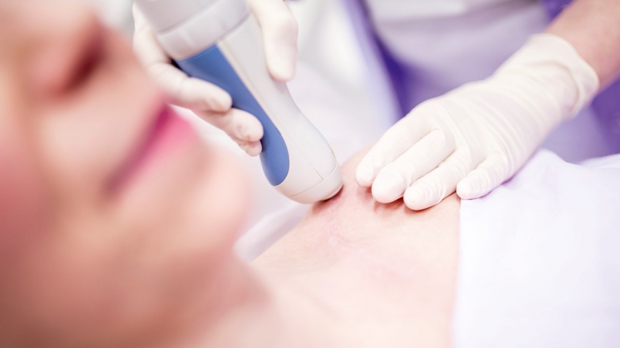 Prestation au laser remboursée par l’assurance maladie